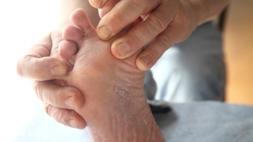 Recognize diabetic foot syndrome from pictures