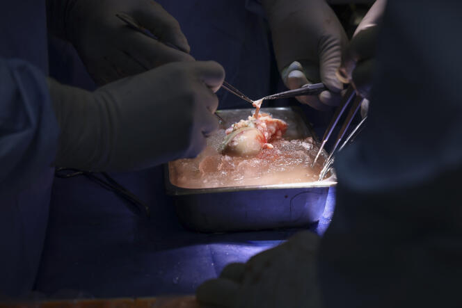 Surgeons are preparing a genetically modified pig kidney for the world's first transplant of a kidney from this source into a living human being.  Image from March 16, 2024, provided by Massachusetts General Hospital in Boston, United States.